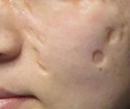 ݷƤҽԺ