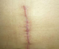 ݷƤҽԺ