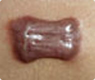 ݷƤҽԺ