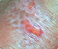 ݷƤҽԺ