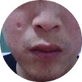 ݷƤҽԺ